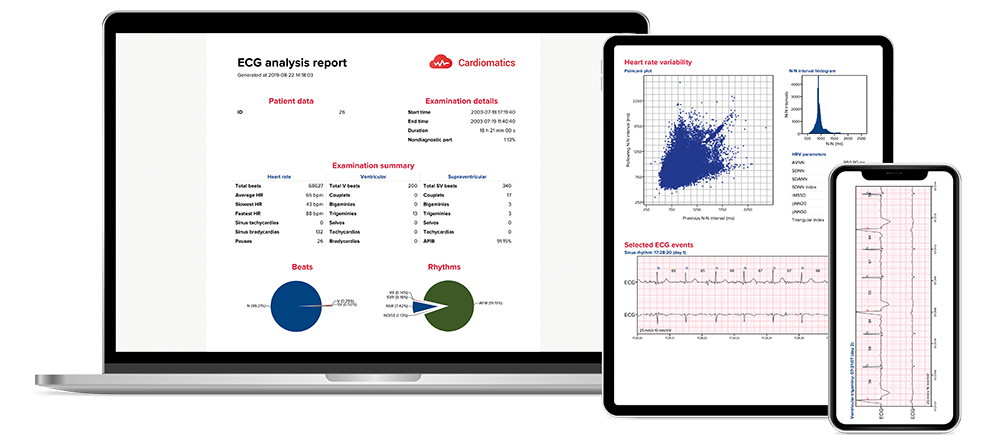 Cardiomatics AI-powered ECG analysis